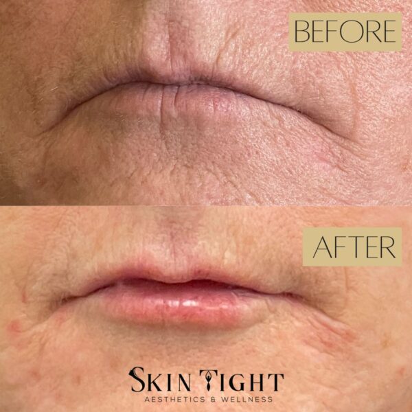 BEFORE AFTER (1)